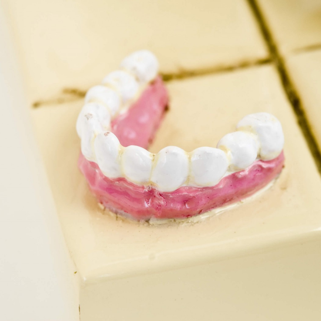 Forchino figure `The Dentist `